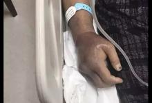 廈大回應附屬醫院院長博士論文抄襲：學術不端，不構成剽竊