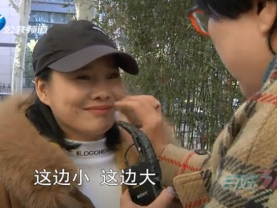 整形有風險！女子在鄭州東方整形醫院手術后臉一邊大一邊小