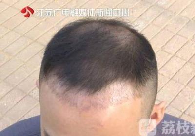 南寧華美醫(yī)院打“水光針”后悲劇了 醫(yī)生還未取得執(zhí)業(yè)醫(yī)生資格證