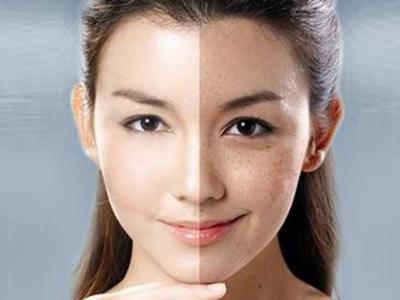 臉上長(zhǎng)斑要怎樣可以去除臉上的斑點(diǎn)