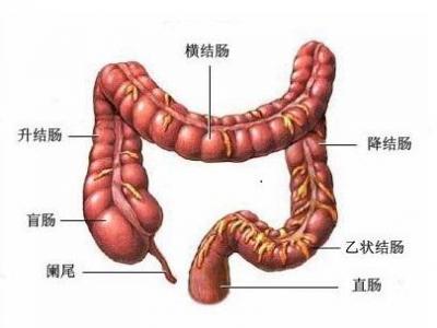 潰瘍性結(jié)腸炎患者飲食需要注意哪些方面