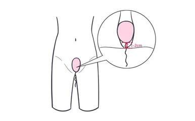 女性陰道瘙癢不止可能暗示四種疾病