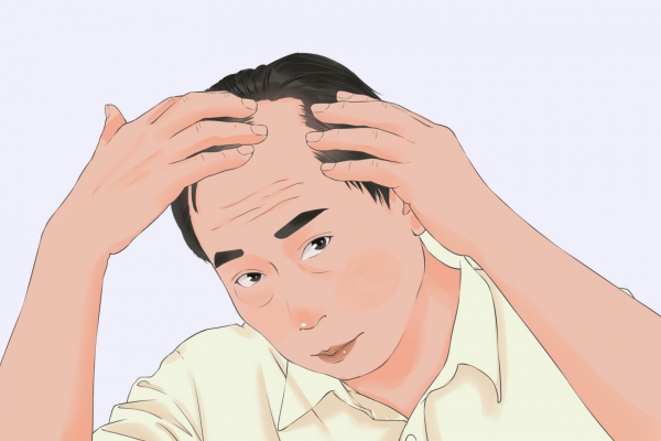 脫發是腎虛嗎