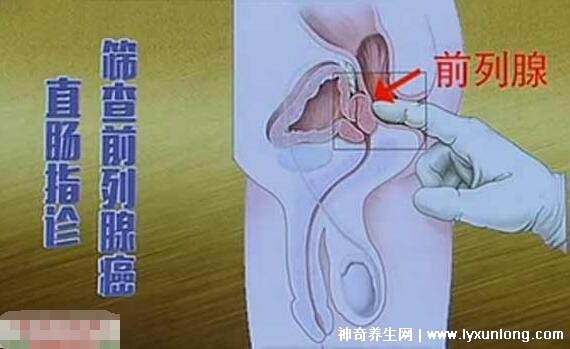 30秒自測(cè)前列腺炎，是否出現(xiàn)尿痛/尿頻/尿急(附自測(cè)方式)