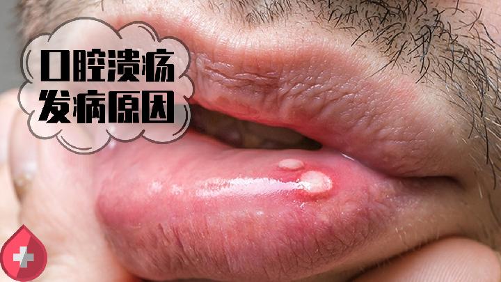 飲食提醒 餐桌上常做這5件事，便可輕松消除脂肪