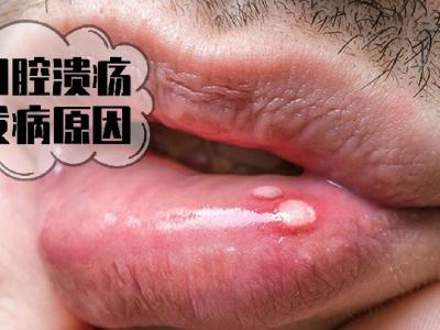 瘦身秘訣 10大高脂肪食品