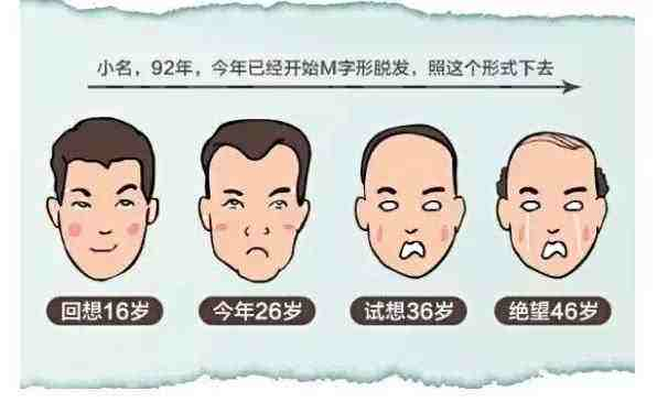 沒有家族脫發(fā)史 我為什么年紀(jì)輕輕也禿了-易網(wǎng)<a href=http://www.weilaijie.cn/ target=_blank class=infotextkey>健康養(yǎng)生</a>網(wǎng) 沒有家族脫發(fā)史 我為什么年紀(jì)輕輕也禿了