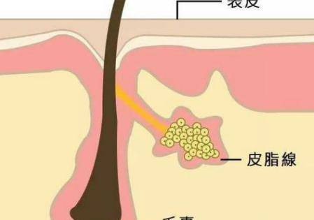 混合性皮膚痘肌T區(qū)總脫妝出油 選對粉底液很重要-易網(wǎng)<a href=http://www.weilaijie.cn/ target=_blank class=infotextkey>健康養(yǎng)生</a>網(wǎng) 混合性皮膚痘肌T區(qū)總脫妝出油 選對粉底液很重要
