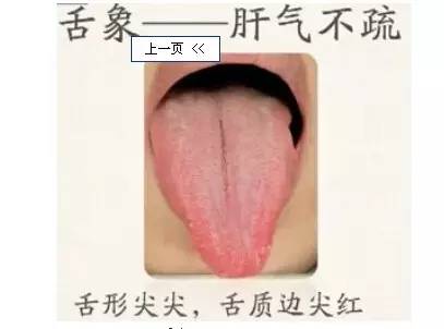 寶寶眼睛紅，是紅眼病嗎？