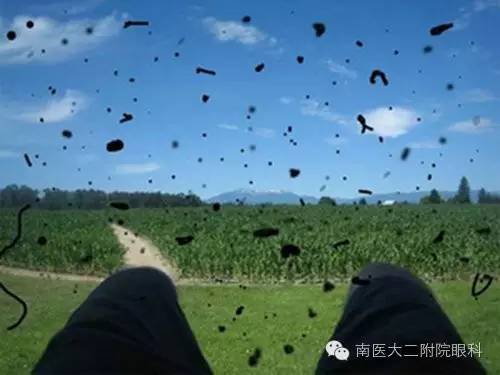 警惕，近視眼更容易得飛蚊癥