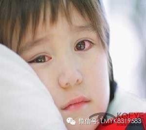慢性結膜炎的原因有哪些？