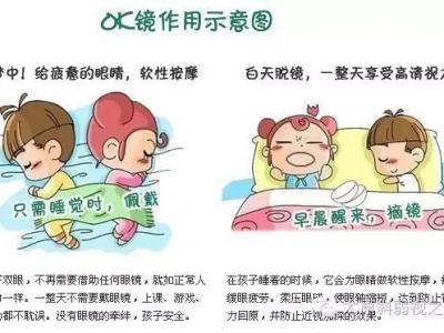 角膜塑形鏡，你知道多少？
