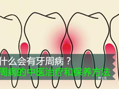 為什么會(huì)有牙周病？牙周病的中醫(yī)治療和保養(yǎng)方法