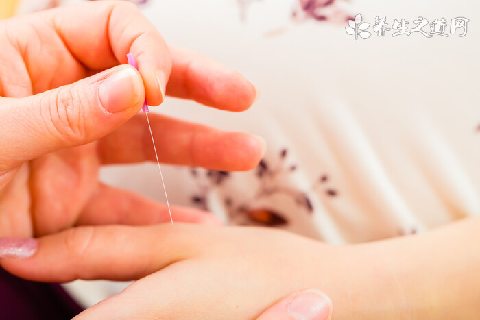 針灸祛痘有效果嗎
