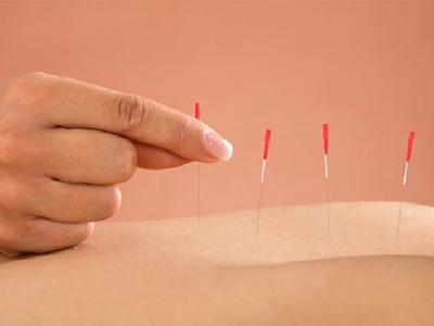 得了急性乳腺炎怎樣針灸治療 女性急性乳腺炎有什么癥狀表現