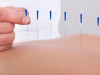 導致女性痛經的原因是什么？女性緩解痛經可試針灸治療